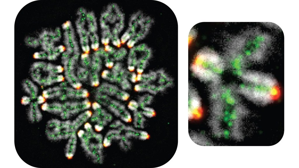 Miscarriages, down syndrome, and infertility all linked to this hidden DNA process | ScienceDaily