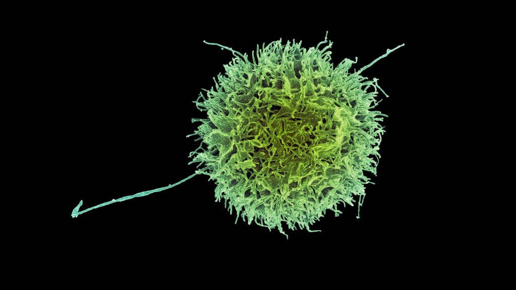 MIT&rsquo;s &ldquo;stealth&rdquo; immune cells could change cancer treatment forever | ScienceDaily