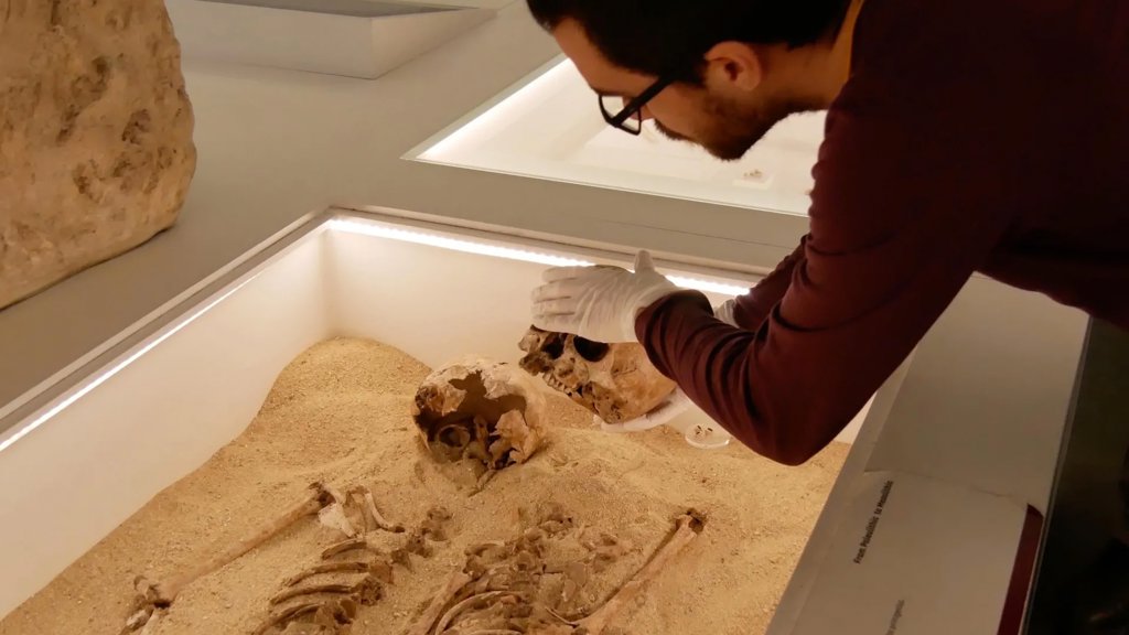 Ancient DNA solves 12,000-year-old mystery of rare genetic growth disorder | ScienceDaily