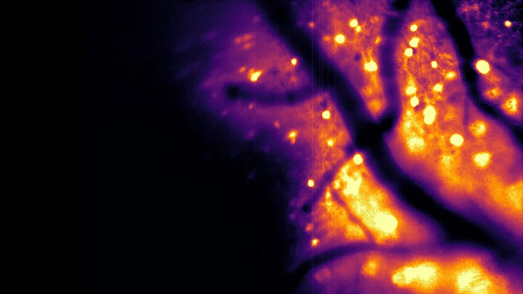 Glowing neurons let scientists watch the brain work in real time | ScienceDaily