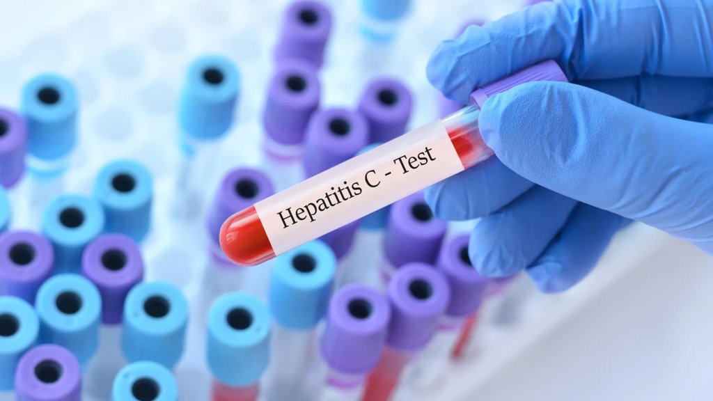 This 15 minute hepatitis C test could change everything | ScienceDaily
