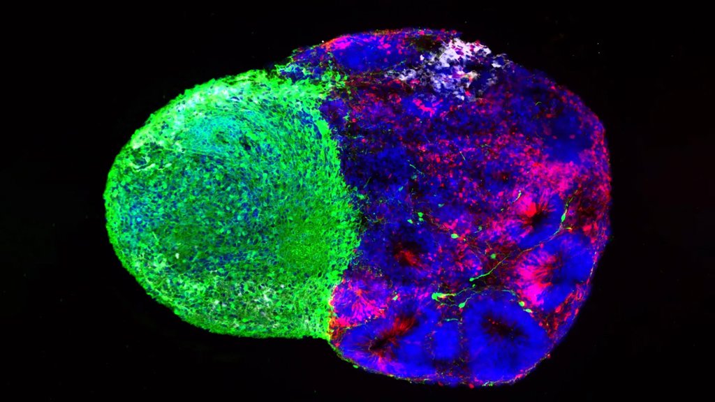 Scientists reveal the hidden instructions that build the human brain | ScienceDaily