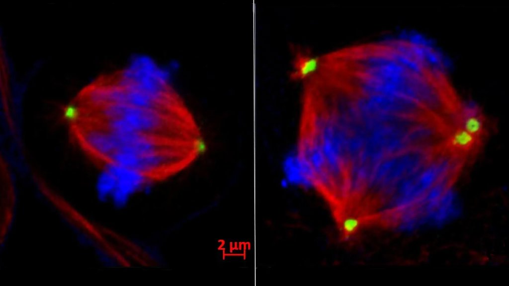 This &ldquo;chaos enzyme&rdquo; may hold the key to stopping cancer spread | ScienceDaily