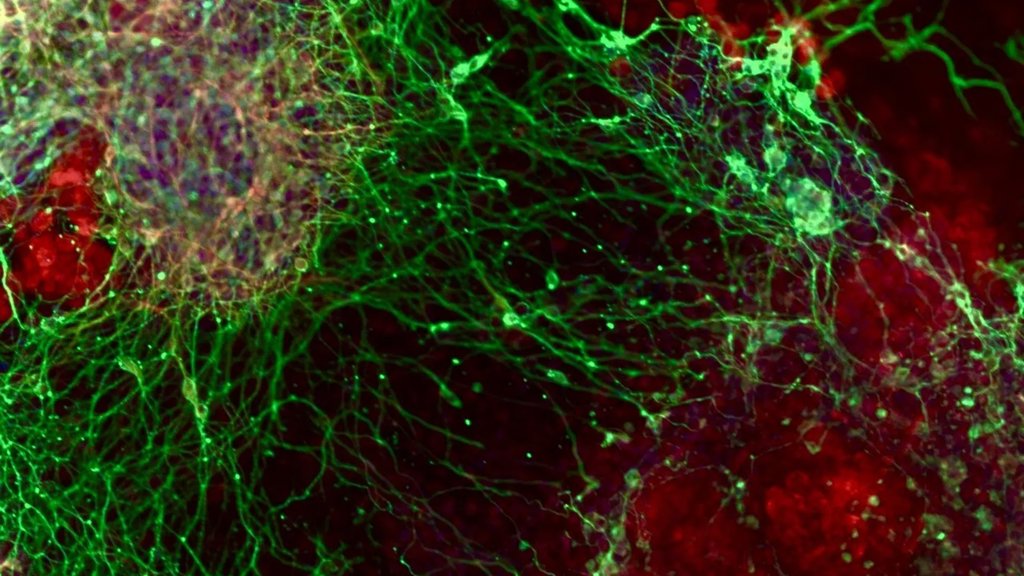 A massive gene hunt reveals how brain cells are made | ScienceDaily