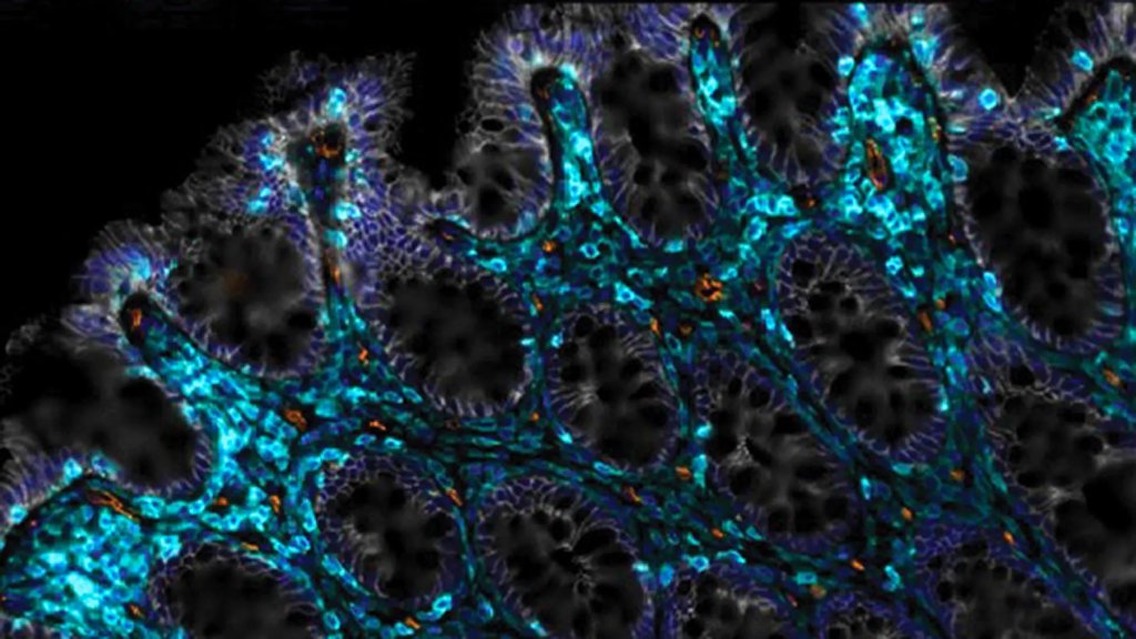 Scientists found a way to help aging guts heal themselves | ScienceDaily