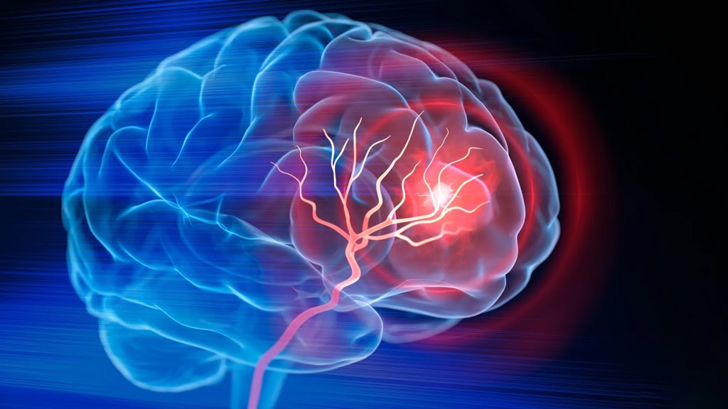 Your brain shows damage before your blood pressure even rises | ScienceDaily