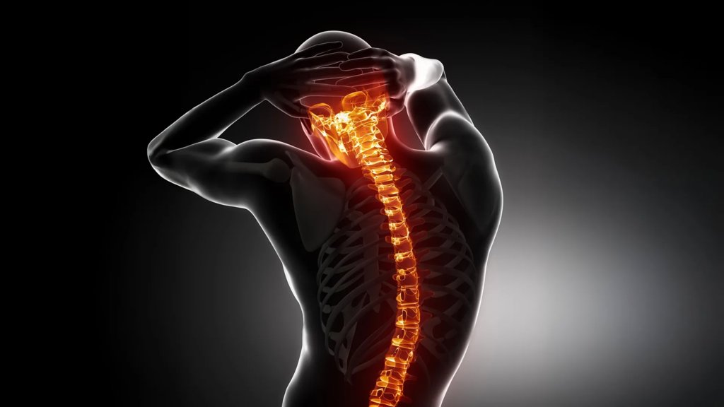 A drug already used for osteoporosis blocked spinal damage in a new study | ScienceDaily