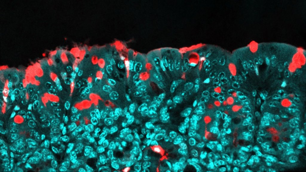 This common food ingredient may shape a child’s health for life | ScienceDaily