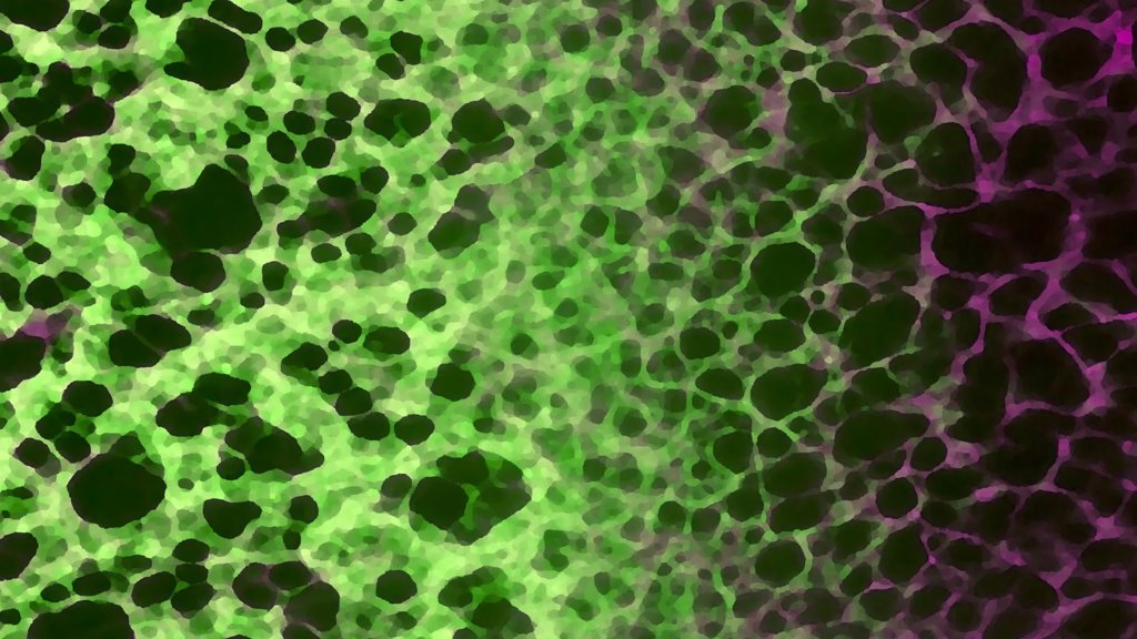 A hidden cellular process may drive aging and disease | ScienceDaily