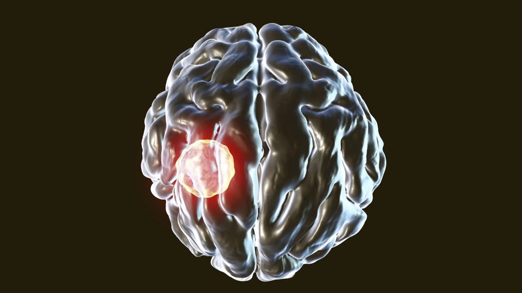 One in three people carry this brain parasite but the body has a kill switch | ScienceDaily