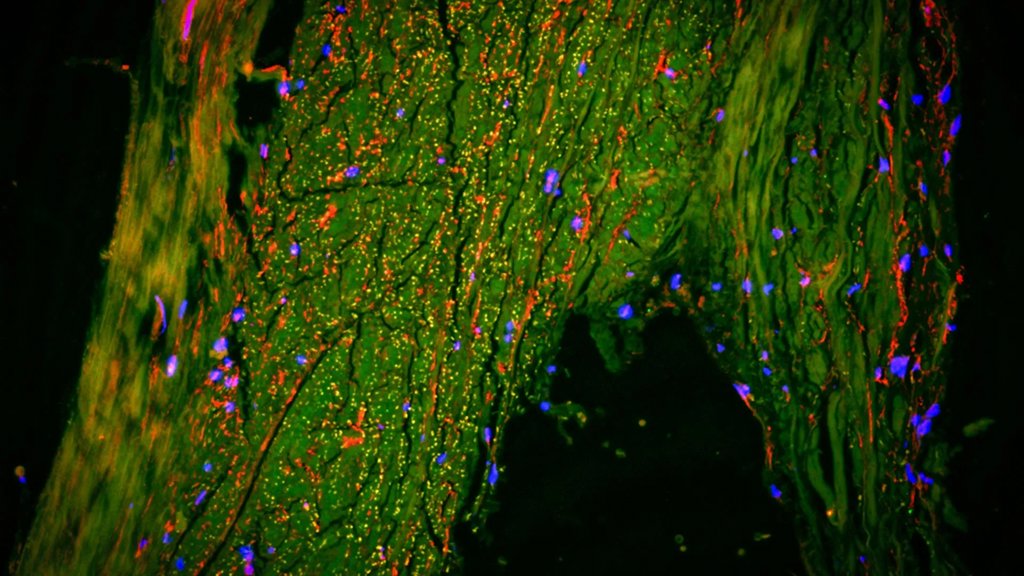 Scientists just found a hidden “drain” inside the human brain | ScienceDaily