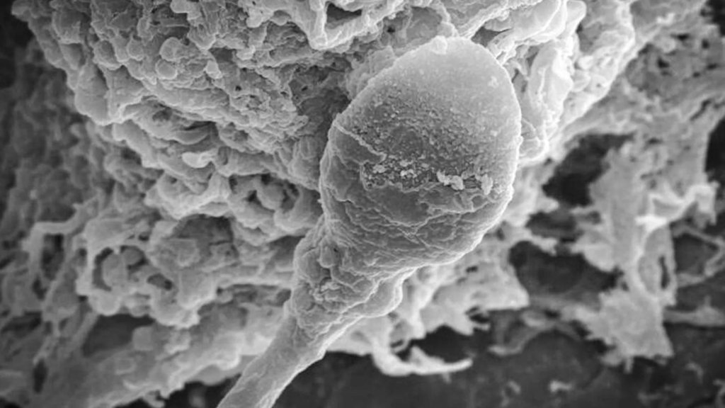 Lost in space: Microgravity makes sperm lose their sense of direction | ScienceDaily