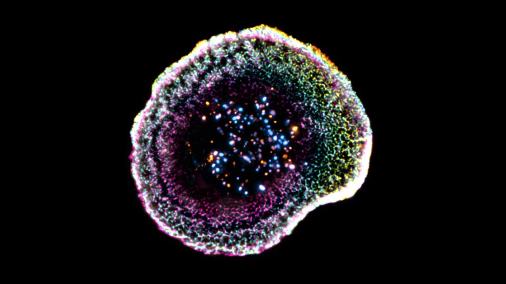 First-ever 3D view shows how killer T cells destroy cancer | ScienceDaily