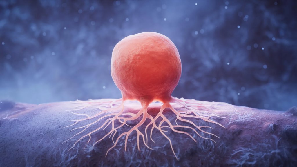 How cutting lipids could starve breast cancer | ScienceDaily