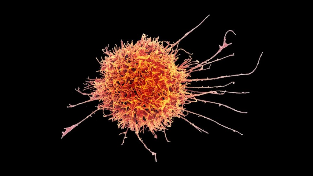 Supercharged “natural killer” cells could be a powerful new cancer weapon | ScienceDaily