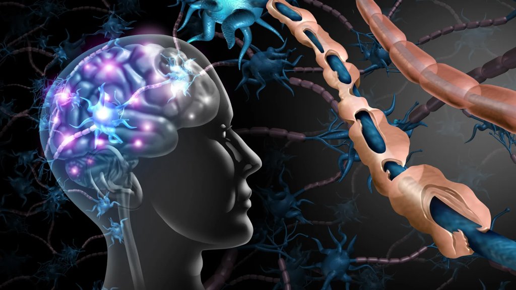 Breakthrough compounds may reverse nerve damage caused by multiple sclerosis | ScienceDaily