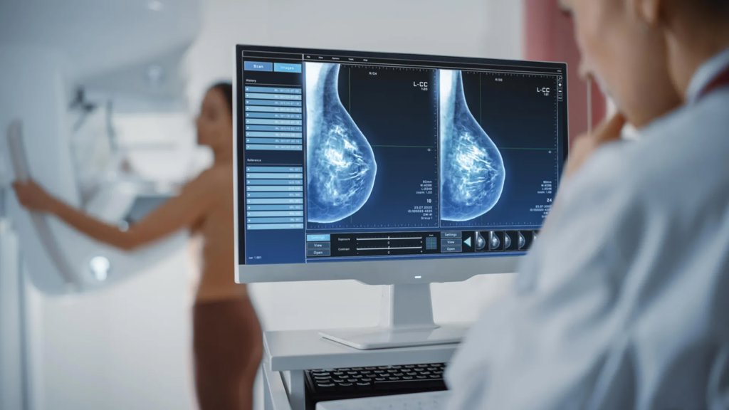 A smarter way to screen for breast cancer is emerging | ScienceDaily