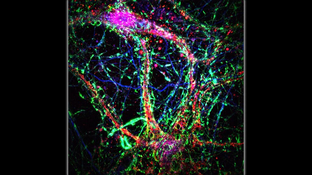 Tiny brain nanotubes found by Johns Hopkins may spread Alzheimer&rsquo;s | ScienceDaily