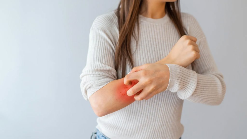 Scientists discover hidden sugar layer behind psoriasis | ScienceDaily