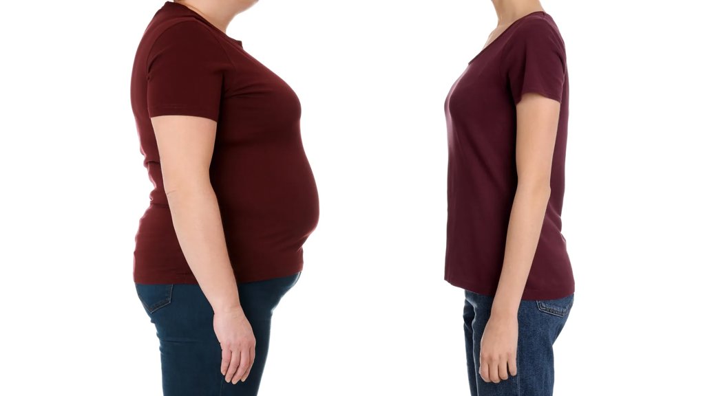 Surgery beats Ozempic for long-term health, Cleveland Clinic finds | ScienceDaily