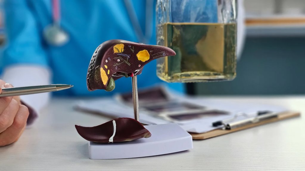 Blocking one enzyme may break the link between alcohol and liver disease | ScienceDaily