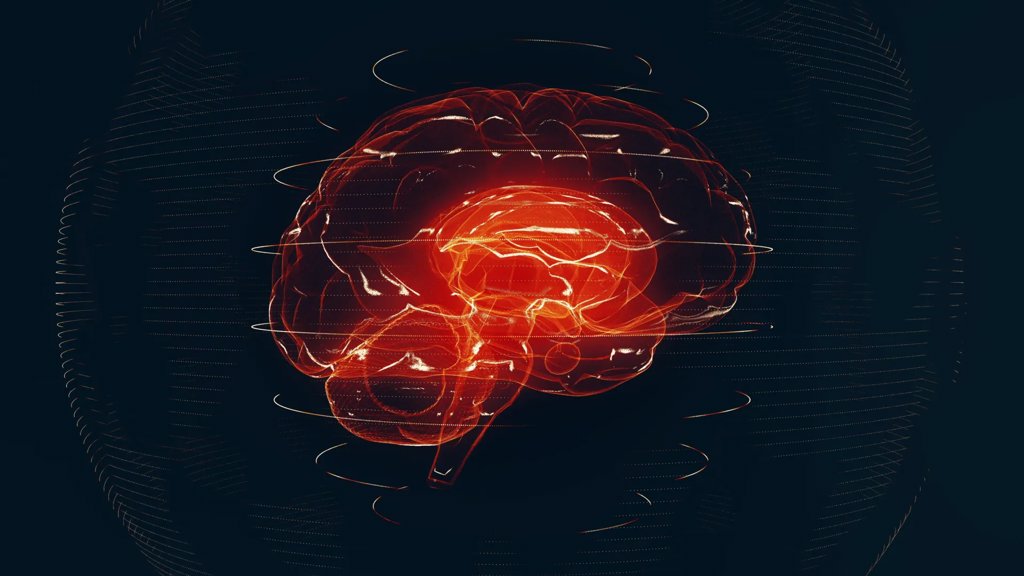 AI reads brain MRIs in seconds and flags emergencies | ScienceDaily