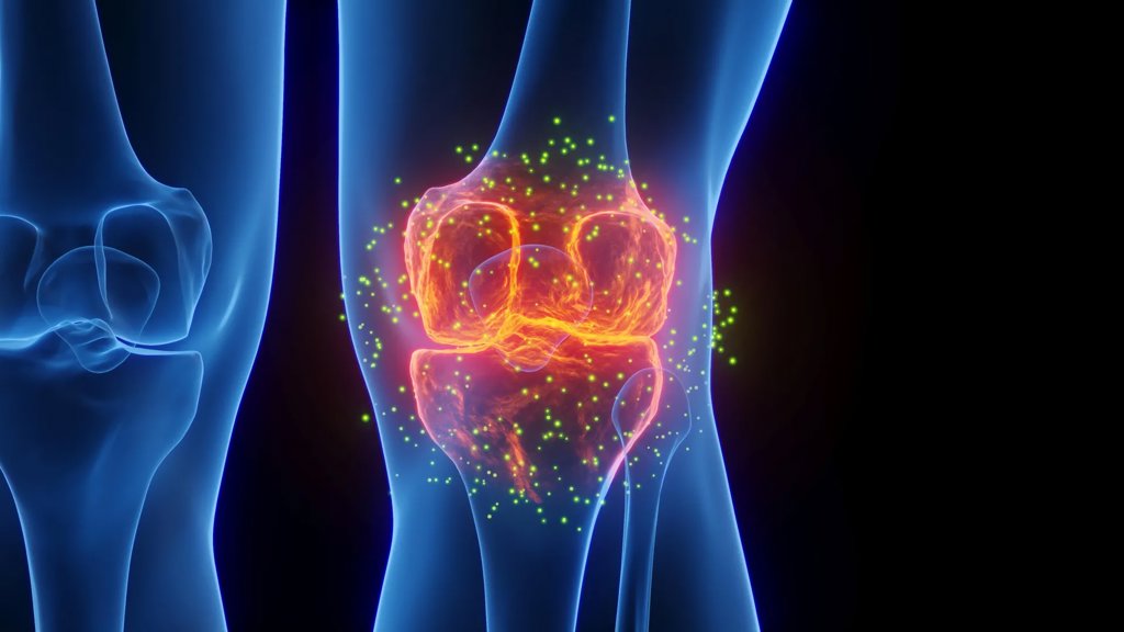 This emerging treatment could help people avoid knee replacement surgery | ScienceDaily