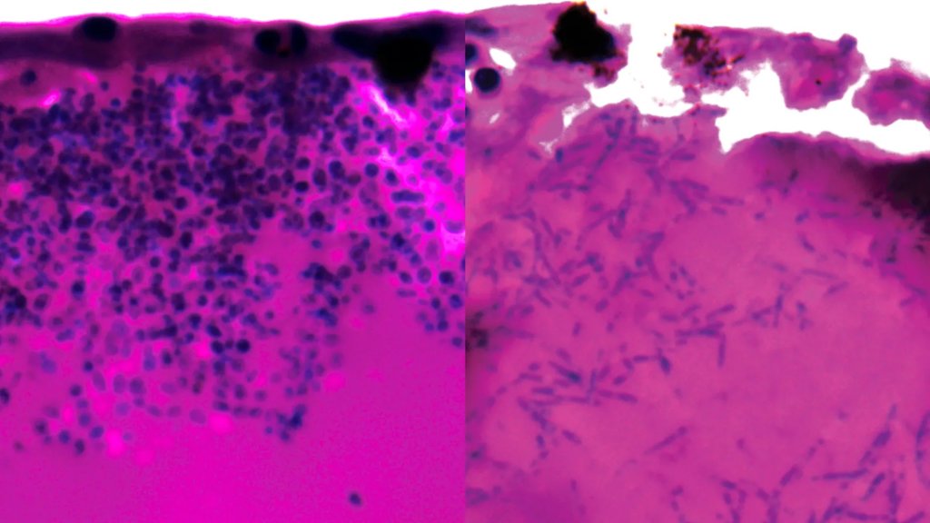 Scientists find a weak spot in deadly fungus that shut down hospital intensive care units | ScienceDaily