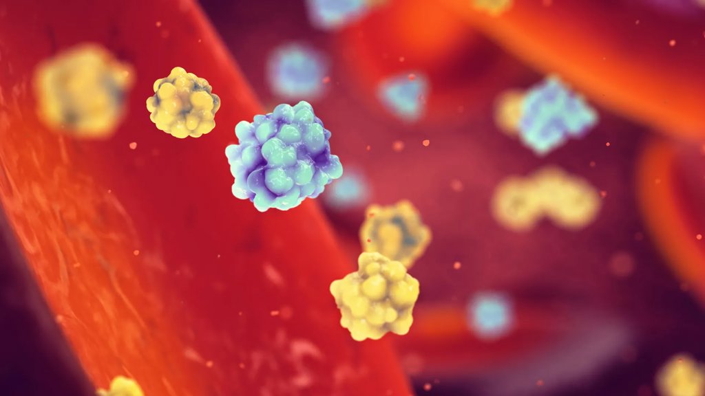 Misfolded insulin may be quietly driving diabetes | ScienceDaily