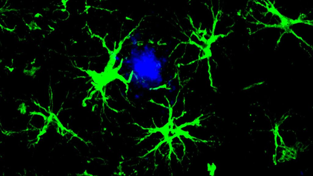 Scientists turn brain cells into Alzheimer’s plaque cleaners | ScienceDaily
