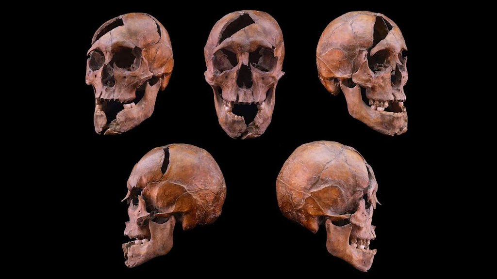 Science finally solves a 700-year-old royal murder | ScienceDaily