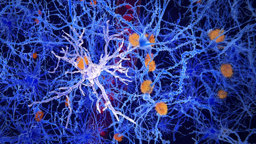 Hidden microglia switch helps protect the brain from Alzheimer’s | ScienceDaily