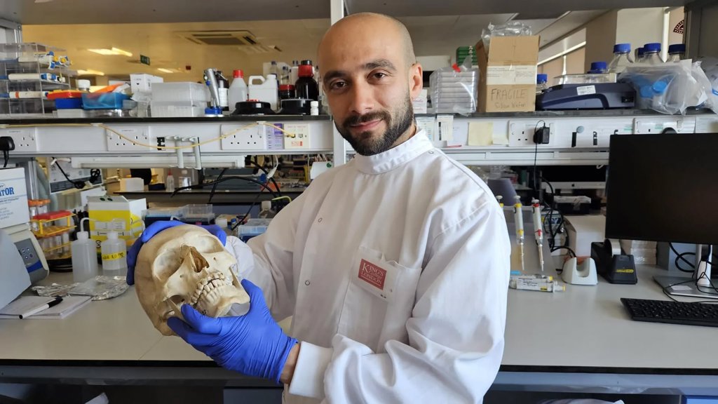Scientists turn sheep’s wool into a material that helps regrow bone | ScienceDaily