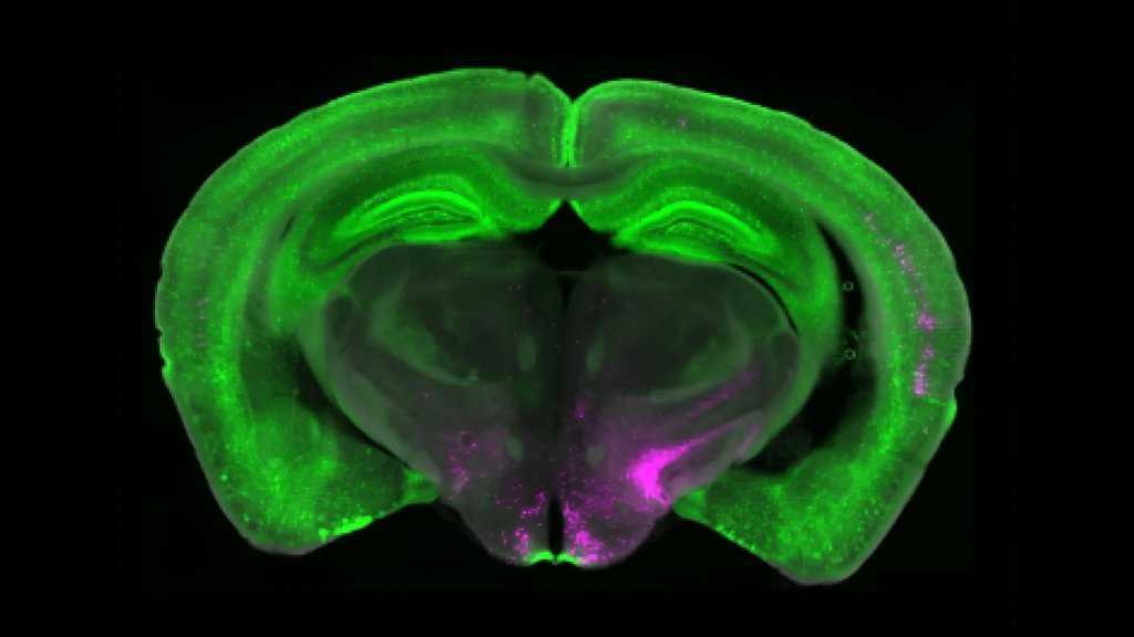 Scientists discover brain circuit that can switch off chronic pain | ScienceDaily