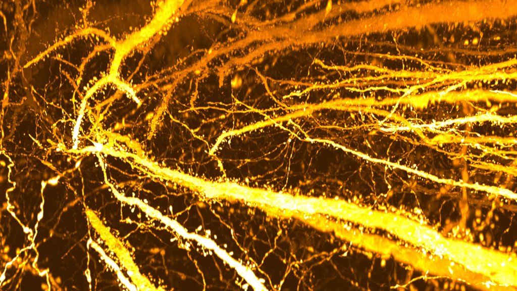 Scientists found hidden synapse hotspots in the teen brain | ScienceDaily