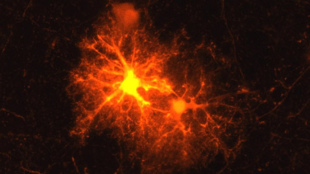 A stress hormone may help the brain repair itself | ScienceDaily