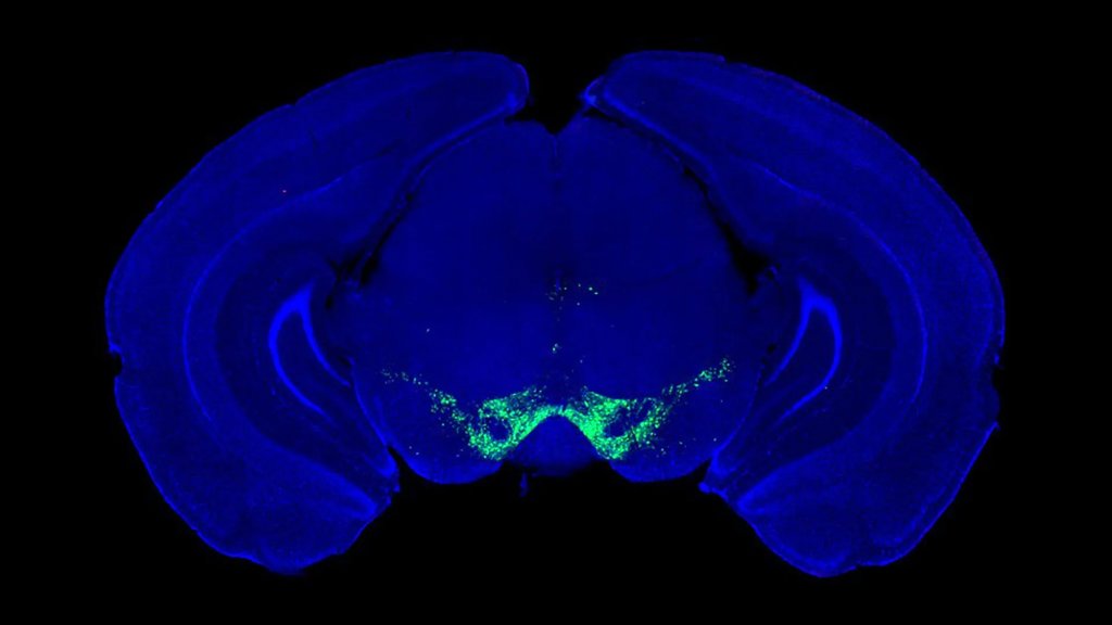 Parkinson’s breakthrough changes what we know about dopamine | ScienceDaily