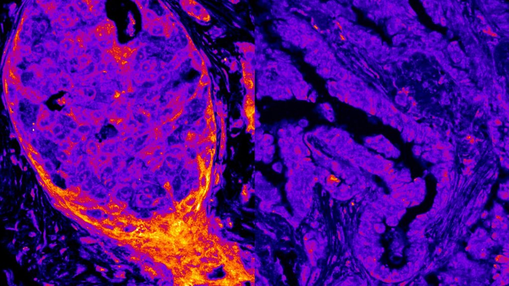 Hidden metabolism found operating inside the cell nucleus | ScienceDaily