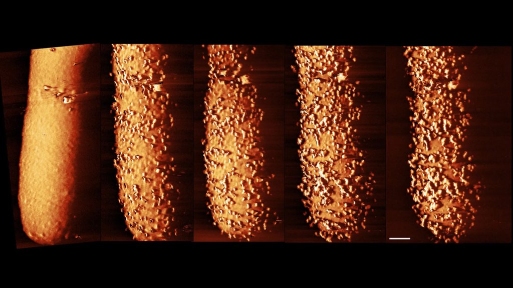 Stunning images reveal how antibiotics shatter bacterial defenses | ScienceDaily