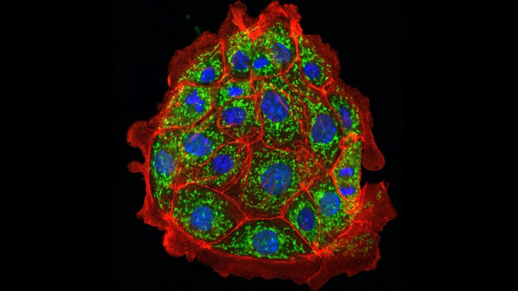 Scientists reverse kidney damage in mice, hope for humans next | ScienceDaily