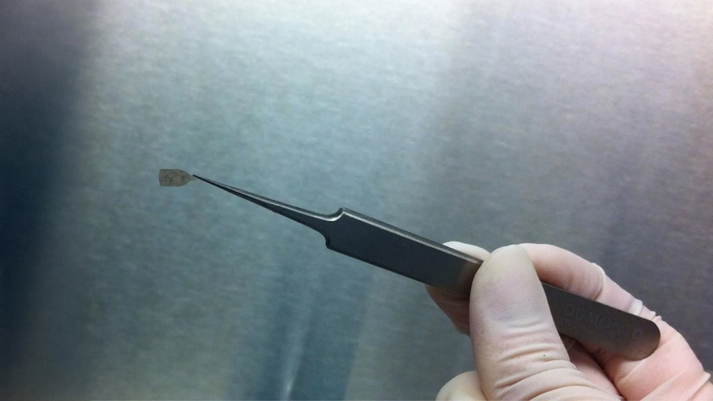 Scientists test a tiny eye implant that could restore sight | ScienceDaily