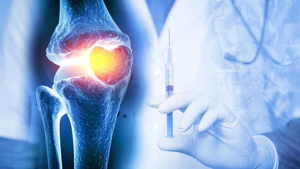 One injection could keep osteoarthritis drugs working for weeks | ScienceDaily