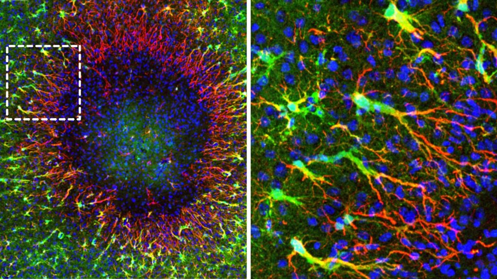The adult brain can repair itself better than scientists thought | ScienceDaily