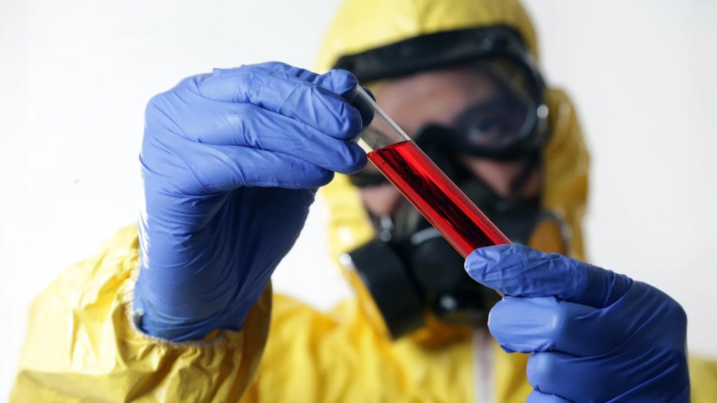Ebola and hantavirus can start like the flu but turn deadly fast | ScienceDaily