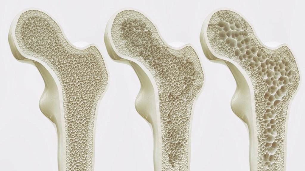 Scientists may have found a way to keep your bones strong for life | ScienceDaily