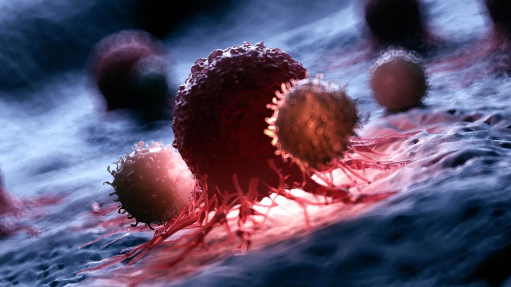 Doctors just found a way to slow one of the deadliest prostate cancers | ScienceDaily
