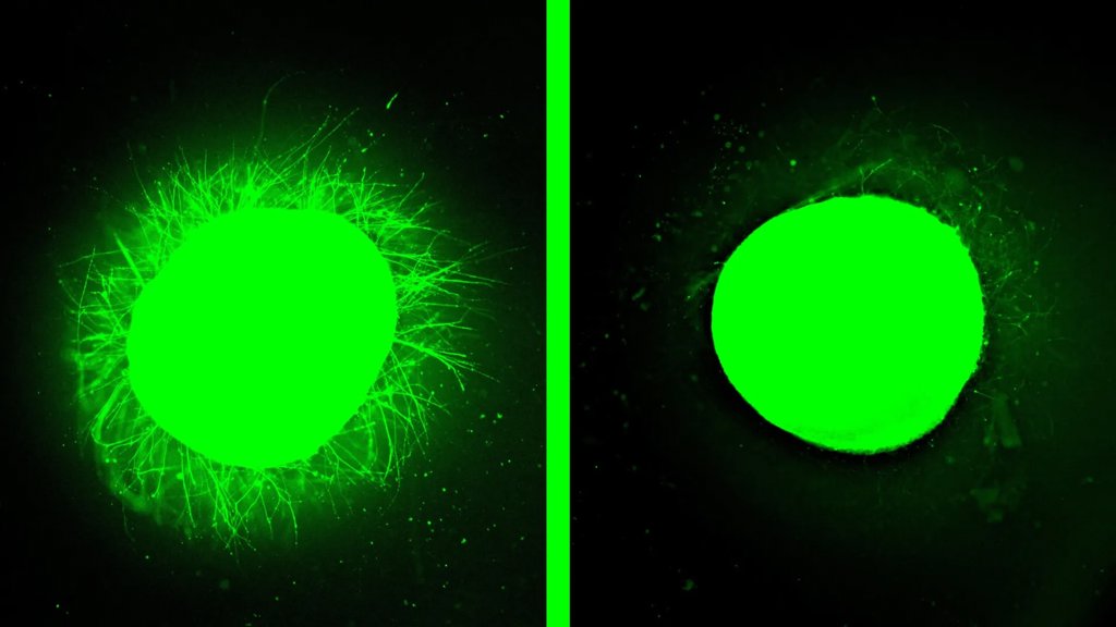 Lab grown human spinal cord heals after injury in major breakthrough | ScienceDaily