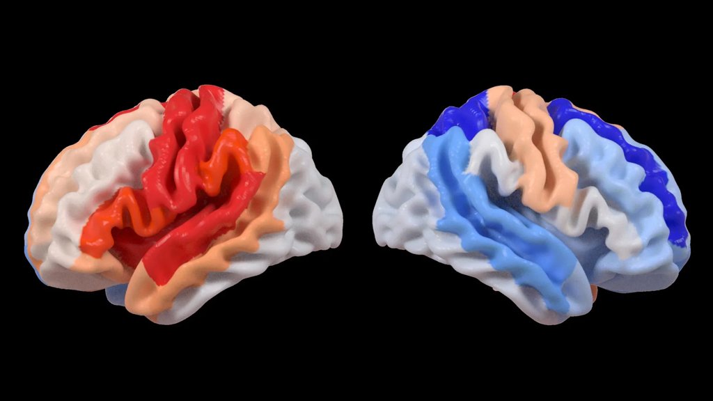 Stroke triggers a hidden brain change that looks like rejuvenation | ScienceDaily