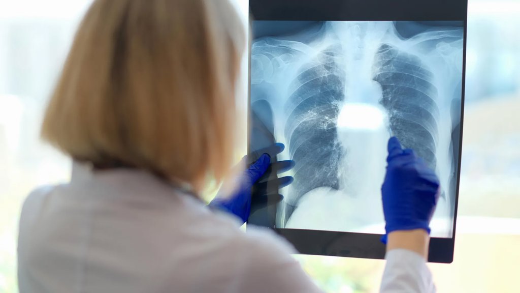 A hidden breathing problem may be behind chronic fatigue&rsquo;s crushing exhaustion | ScienceDaily