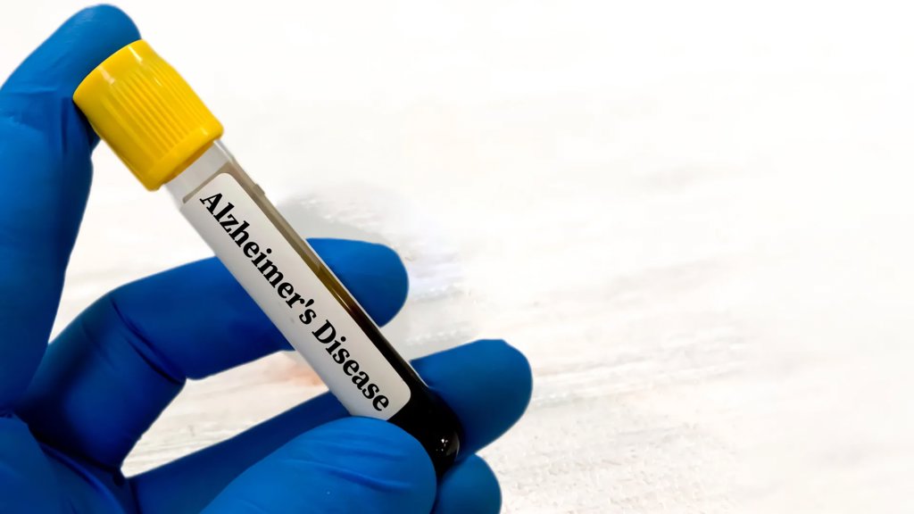 Alzheimer’s blood tests may be misleading for people with kidney problems | ScienceDaily
